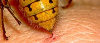 Consejos para la salud: cómo tratar las picaduras y qué hacer ante una reacción alérgica. Eliminar plagas de insectos.